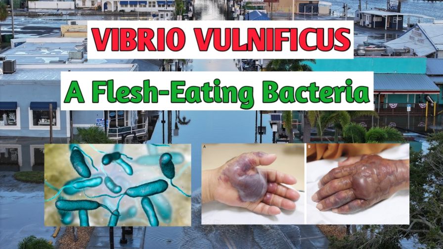 Vibrio Vulnificus